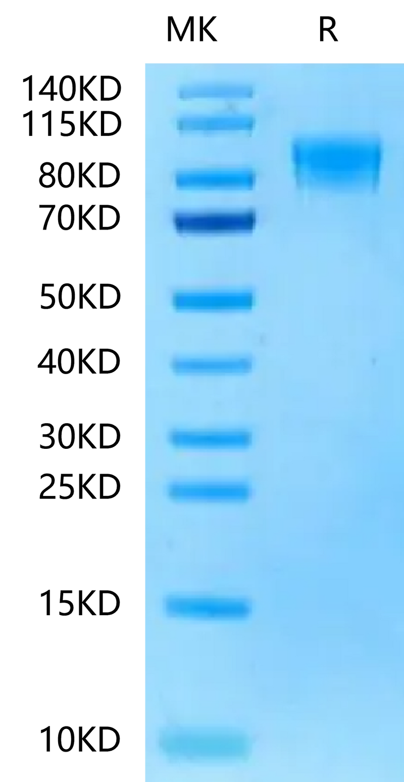 Rat PDGF R beta on Tris-Bis PAGE under reduced condition. The purity is greater than 95%.Recombinant Rat PDGF R beta/CD140b Protein, Active
