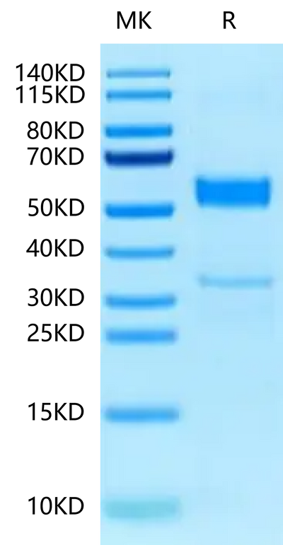 Human CLEC2B on Tris-Bis PAGE under reduced condition. The purity is greater than 95%.Recombinant Human CLEC2B Protein