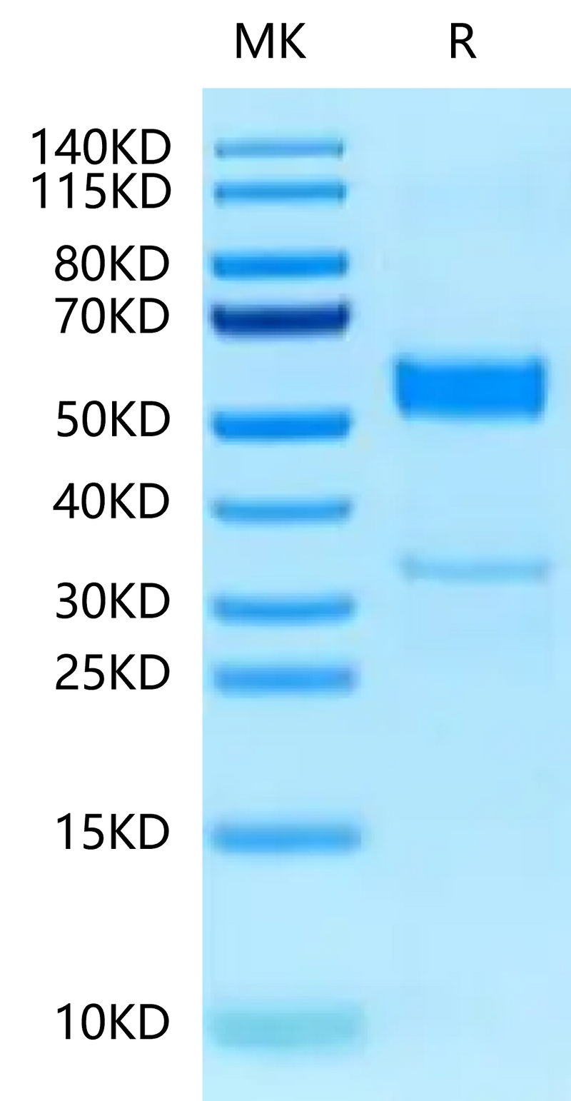 Human CLEC2B on Tris-Bis PAGE under reduced condition. The purity is greater than 95%.Recombinant Human CLEC2B Protein