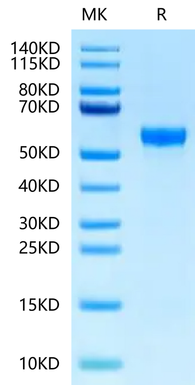 Rat Serpina3n on Tris-Bis PAGE under reduced condition. The purity is greater than 95%.Recombinant Rat Serpina3n Protein