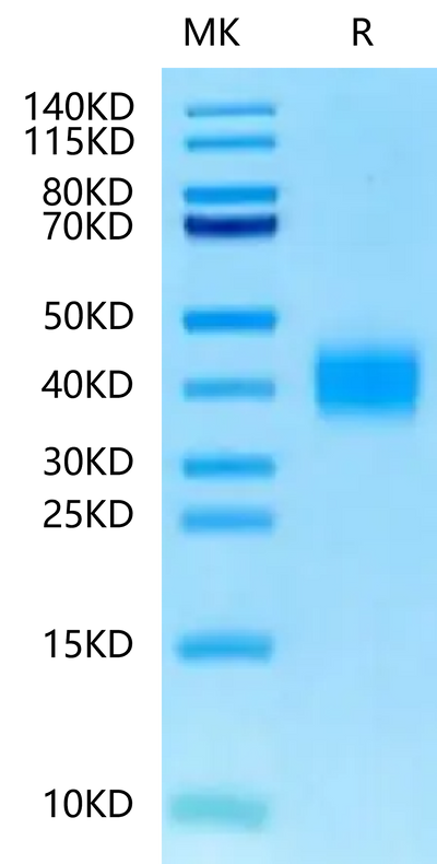 Mouse TFPI-2 on Tris-Bis PAGE under reduced condition. The purity is greater than 95%.Recombinant Mouse TFPI-2 Protein