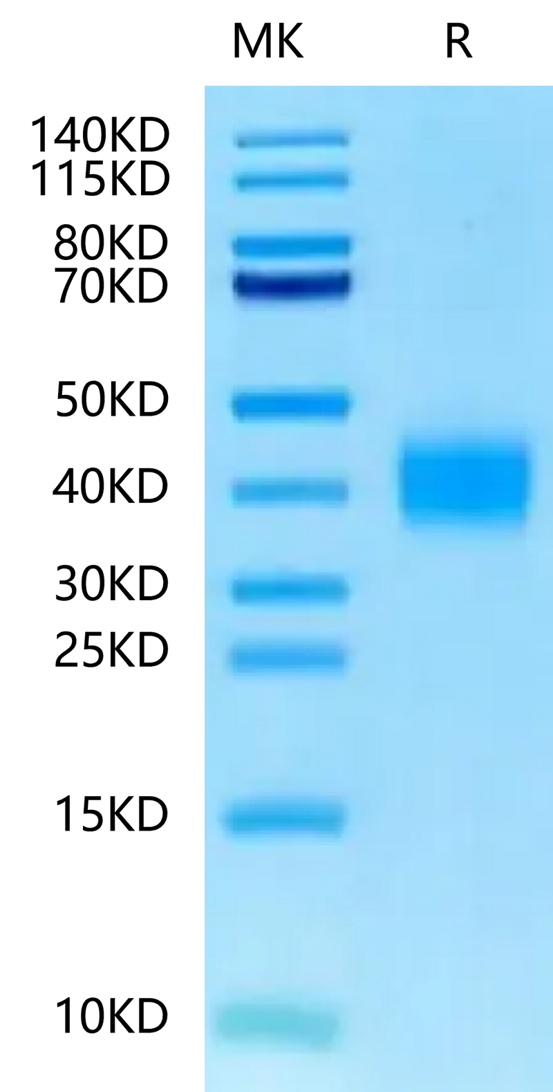 Mouse TFPI-2 on Tris-Bis PAGE under reduced condition. The purity is greater than 95%.Recombinant Mouse TFPI-2 Protein