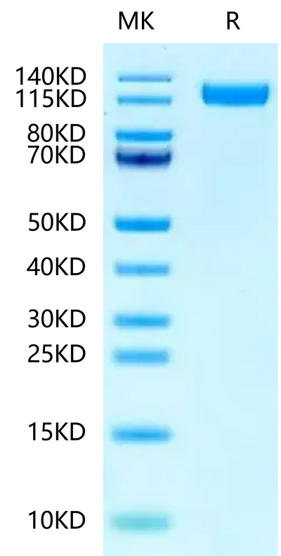 Human P-Selectin on Tris-Bis PAGE under reduced condition. The purity is greater than 95%.Recombinant Human P-Selectin/CD62P Protein, Active