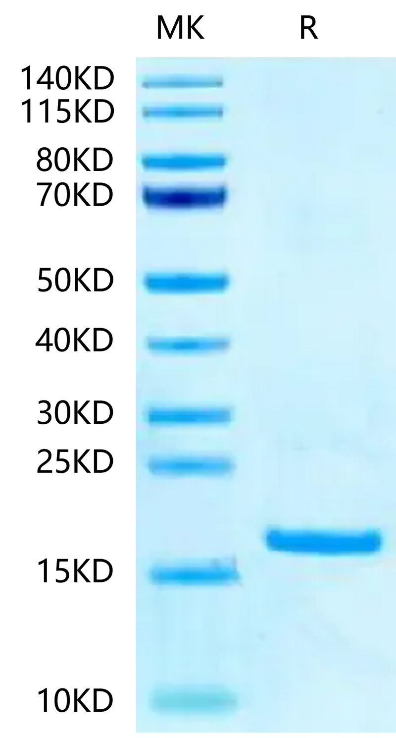 Ferret TNF alpha on Tris-Bis PAGE under reduced condition. The purity is greater than 95%.Recombinant Ferret TNF alpha-Protein, Active