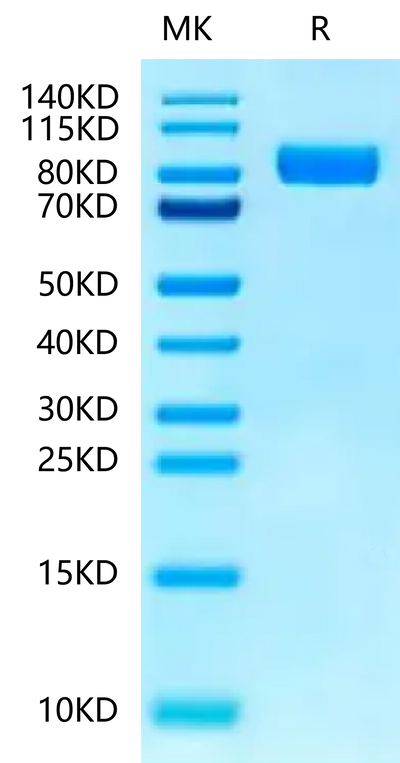 Human IL-1RL1 on Tris-Bis PAGE under reduced condition. The purity is greater than 95%.Recombinant Human IL-1RL1/ST2 Protein, Active