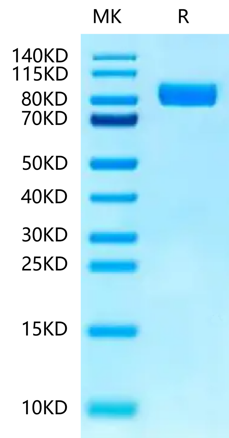 Human IL-1RL1 on Tris-Bis PAGE under reduced condition. The purity is greater than 95%.Recombinant Human IL-1RL1/ST2 Protein, Active