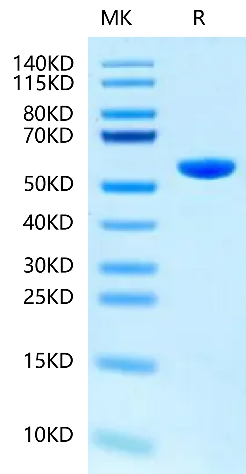 Human HLA-B*15:01&B2M&SARS-CoV-2 epitope (NQKLIANQF) Monomer on Tris-Bis PAGE under reduced condition. The purity is greater than 95%.Recombinant Human HLA-B*15:01&B2M&SARS-CoV-2 epitope (NQKLIANQF) Monomer Protein