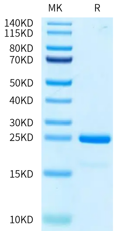 Human SKP1 on Tris-Bis PAGE under reduced condition. The purity is greater than 95%.Recombinant Human SKP1 Protein