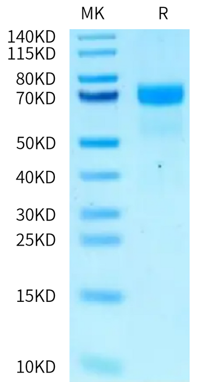 Mouse PSAP on Tris-Bis PAGE under reduced condition. The purity is greater than 95%.Recombinant Mouse PSAP/Prosaposin Protein
