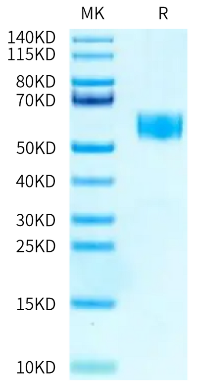 Human SIGIRR on Tris-Bis PAGE under reduced condition. The purity is greater than 95%.Recombinant Human SIGIRR Protein