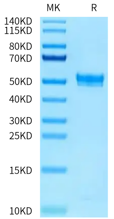 Rat PAI-1 on Tris-Bis PAGE under reduced condition. The purity is greater than 95%.Recombinant Rat PAI-1 Protein
