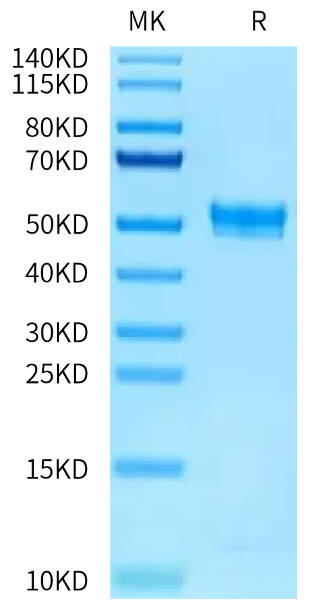 Rat PAI-1 on Tris-Bis PAGE under reduced condition. The purity is greater than 95%.Recombinant Rat PAI-1 Protein