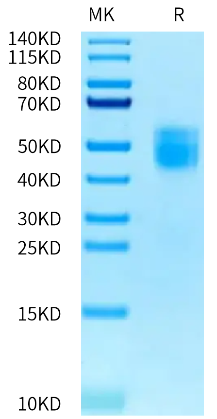 Biotinylated Human IL-10 R alpha on Tris-Bis PAGE under reduced condition. The purity is greater than 95%.Biotinylated Human IL-10 R alpha Protein, Active