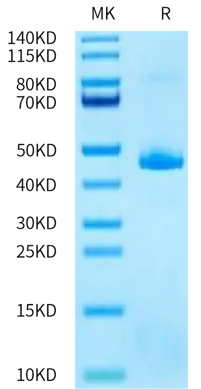 Human TAFA2 on Tris-Bis PAGE under reduced condition. The purity is greater than 95%.Recombinant Human TAFA2/FAM19A2 Protein