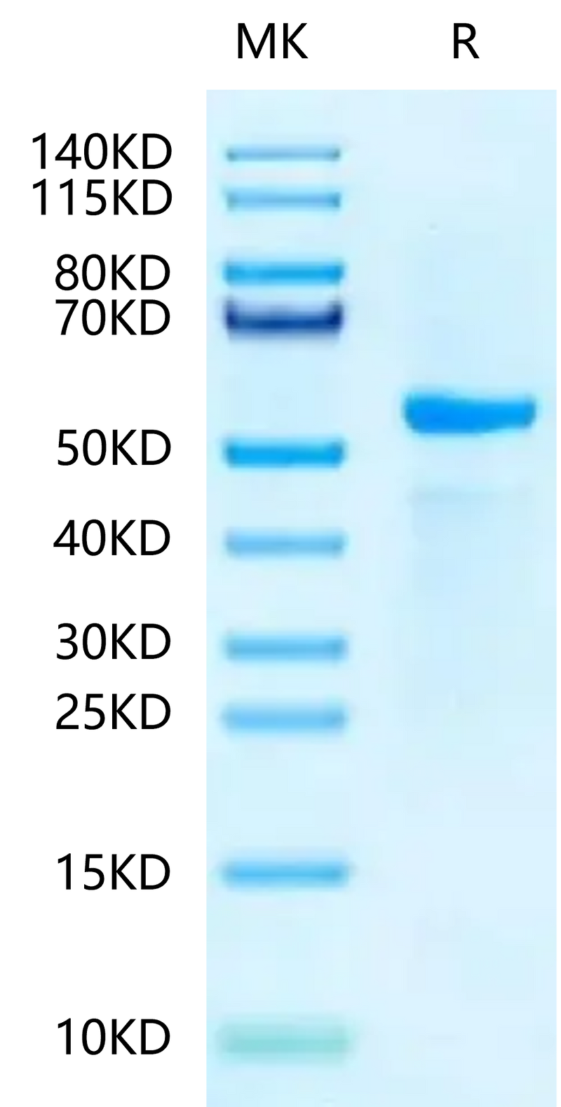 Biotinylated Human Peptide Ready HLA-A*03:01&B2M Monomer on Tris-Bis PAGE under reduced condition. The purity is greater than 95%.Biotinylated Human Peptide Ready HLA-A*03:01&B2M Monomer-Protein, Active