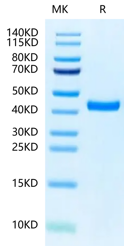 Biotinylated Mouse FGL2 on Tris-Bis PAGE under reduced condition. The purity is greater than 95%.Biotinylated Mouse FGL2 Protein