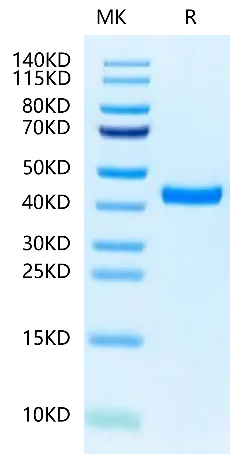 Biotinylated Mouse FGL2 on Tris-Bis PAGE under reduced condition. The purity is greater than 95%.Biotinylated Mouse FGL2 Protein