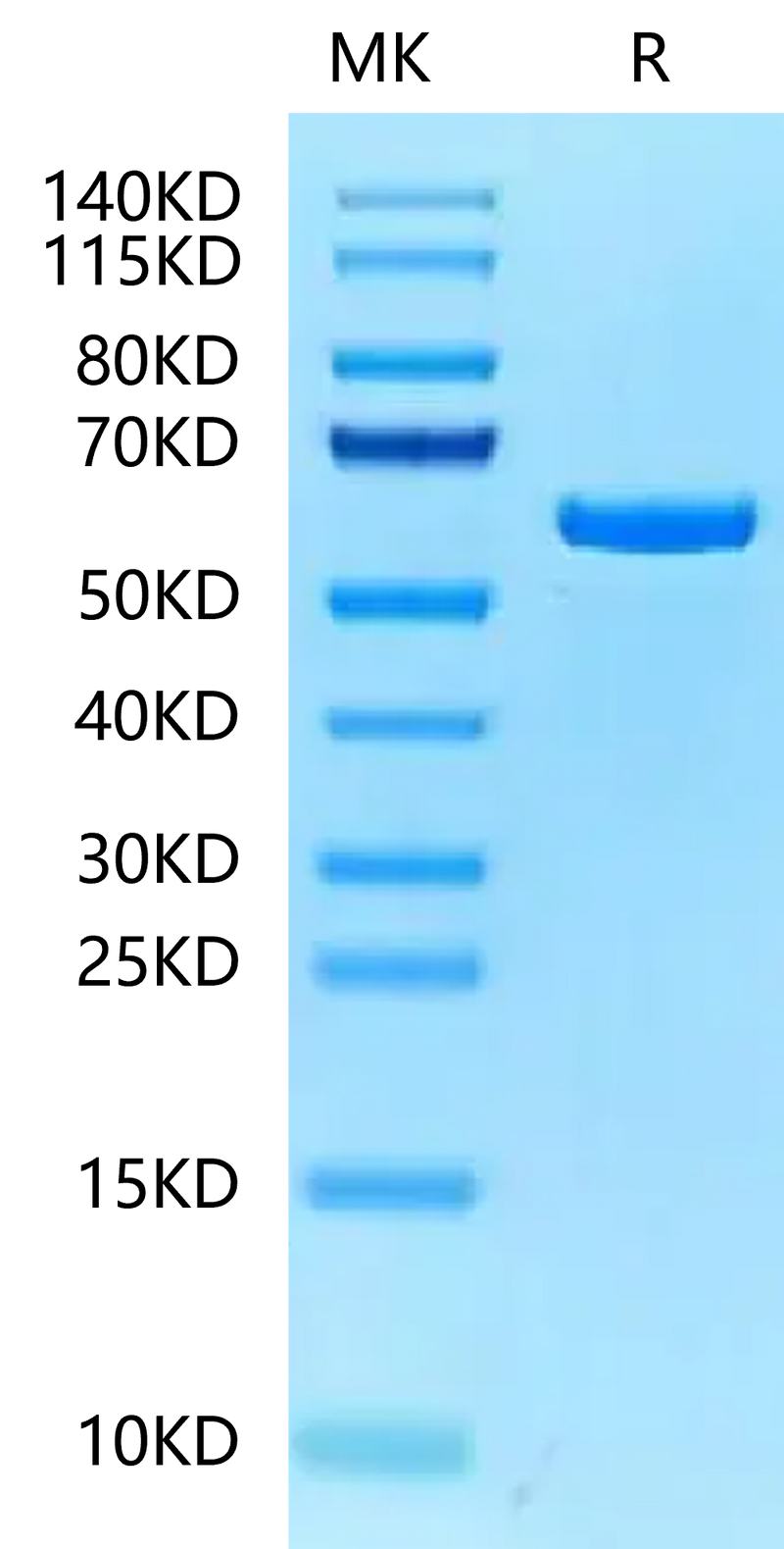 Mouse P4HB on Tris-Bis PAGE under reduced condition. The purity is greater than 95%.Recombinant Mouse P4HB Protein