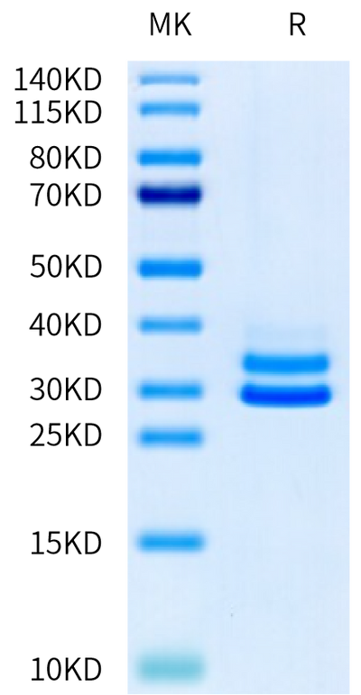 Mouse JAM-A on Tris-Bis PAGE under reduced condition. The purity is greater than 95%.Recombinant Mouse JAM-A Protein