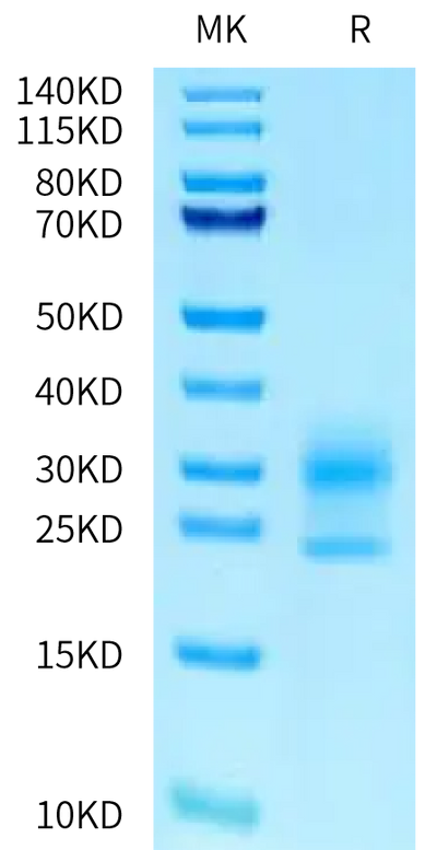 Human NPC2 on Tris-Bis PAGE under reduced condition. The purity is greater than 95%.Recombinant Human NPC2 Protein