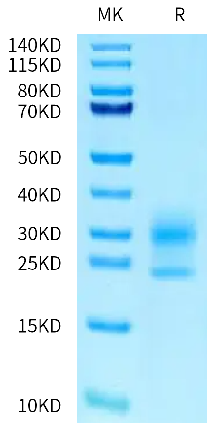 Human NPC2 on Tris-Bis PAGE under reduced condition. The purity is greater than 95%.Recombinant Human NPC2 Protein