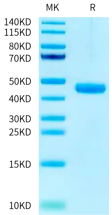 Mouse Cathepsin H on Tris-Bis PAGE under reduced condition. The purity is greater than 95%.Recombinant Mouse Cathepsin H Protein