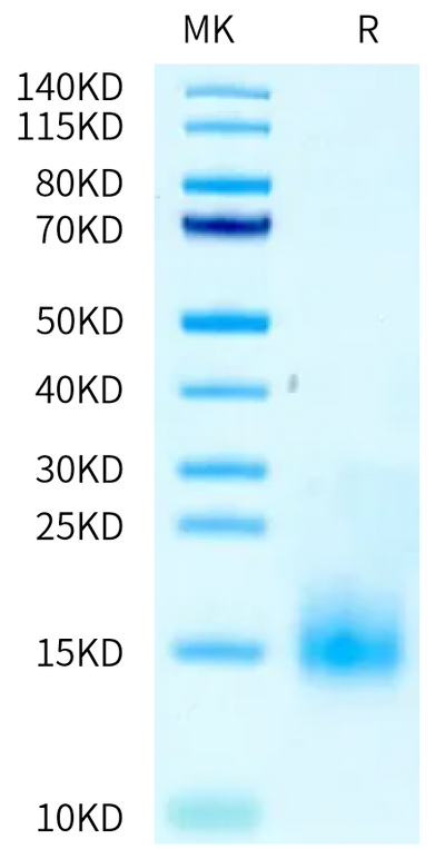 Cynomolgus/Rhesus macaque BCMA on Tris-Bis PAGE under reduced condition. The purity is greater than 95%.Recombinant Cynomolgus/Rhesus macaque BCMA/TNFRSF17 Protein, Active