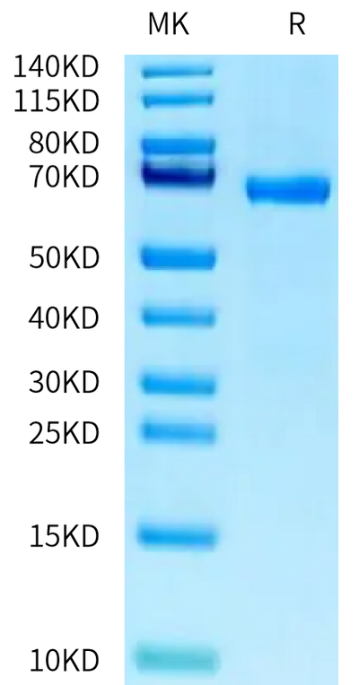 Human ABO on Tris-Bis PAGE under reduced condition. The purity is greater than 95%.Recombinant Human ABO Protein