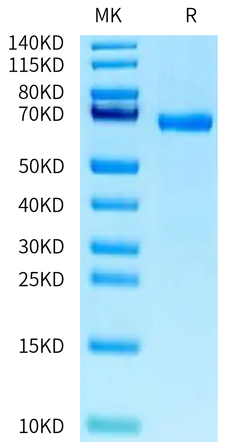 Human ABO on Tris-Bis PAGE under reduced condition. The purity is greater than 95%.Recombinant Human ABO Protein