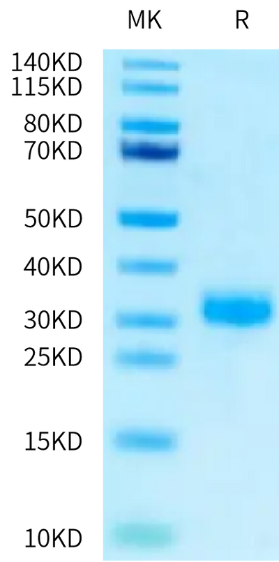 Human RNF43 on Tris-Bis PAGE under reduced condition. The purity is greater than 95%.Recombinant Human RNF43 Protein, Active