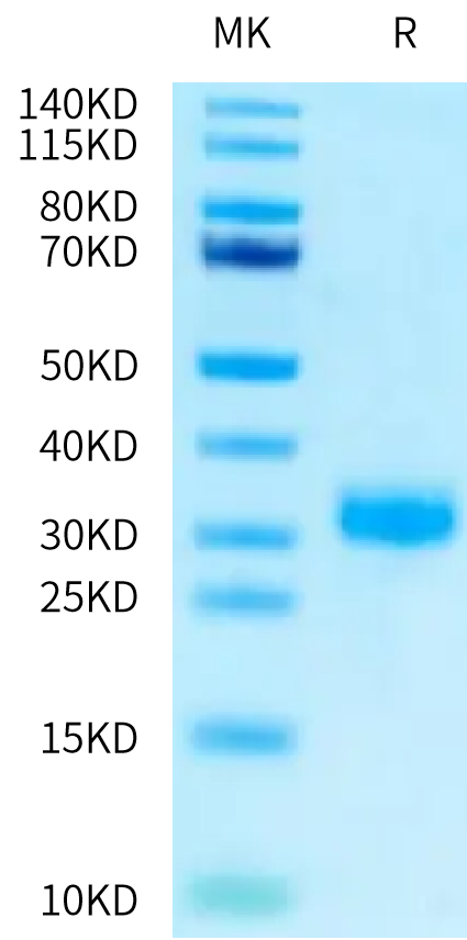 Human RNF43 on Tris-Bis PAGE under reduced condition. The purity is greater than 95%.Recombinant Human RNF43 Protein, Active