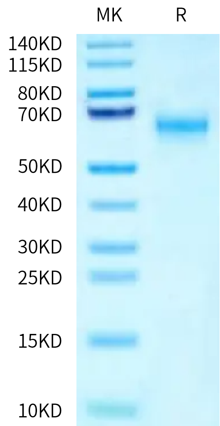 Human SMOC1 on Tris-Bis PAGE under reduced condition. The purity is greater than 95%.Recombinant Human SMOC1 Protein