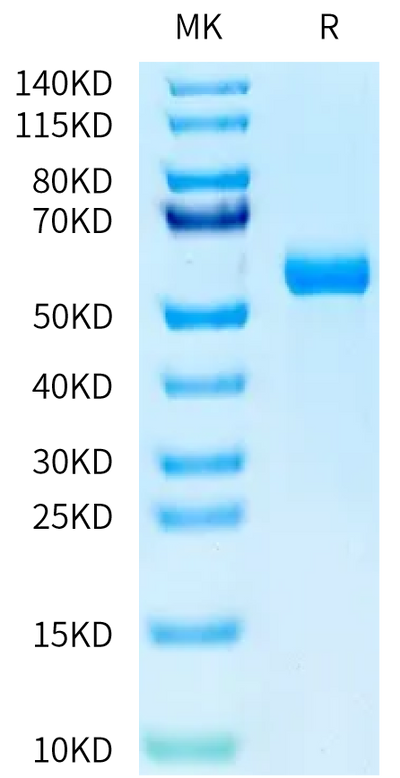 Human HAI-1 on Tris-Bis PAGE under reduced condition. The purity is greater than 95%.Recombinant Human HAI-1 Protein