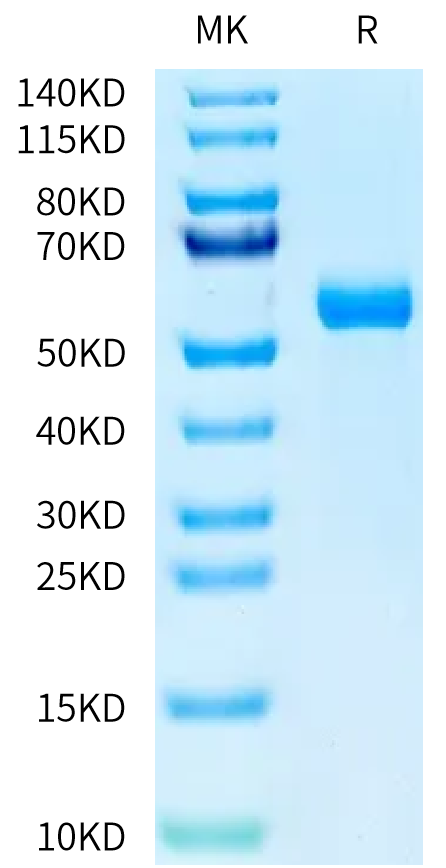 Human HAI-1 on Tris-Bis PAGE under reduced condition. The purity is greater than 95%.Recombinant Human HAI-1 Protein