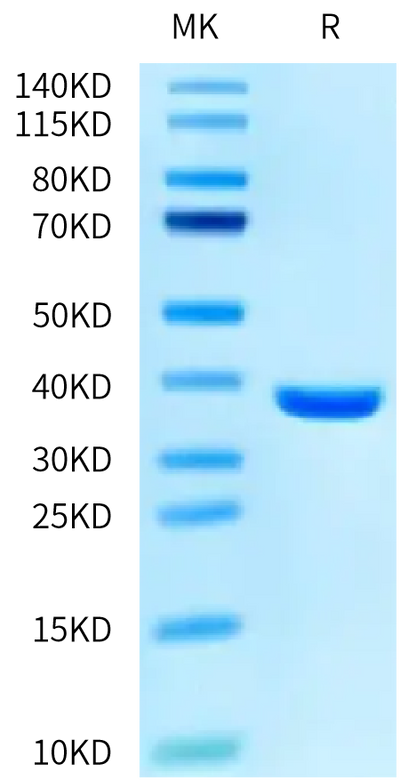SARS PLpro on Tris-Bis PAGE under reduced condition. The purity is greater than 95%.Recombinant SARS PLpro/papain-like protease Protein