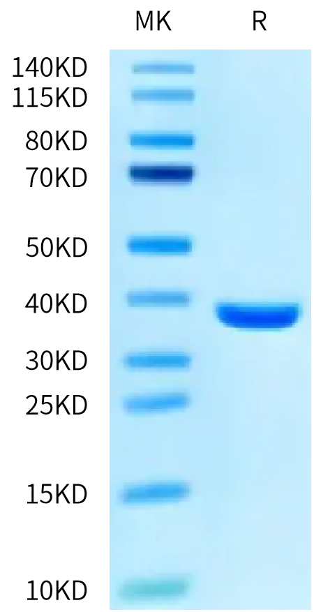 SARS PLpro on Tris-Bis PAGE under reduced condition. The purity is greater than 95%.Recombinant SARS PLpro/papain-like protease Protein