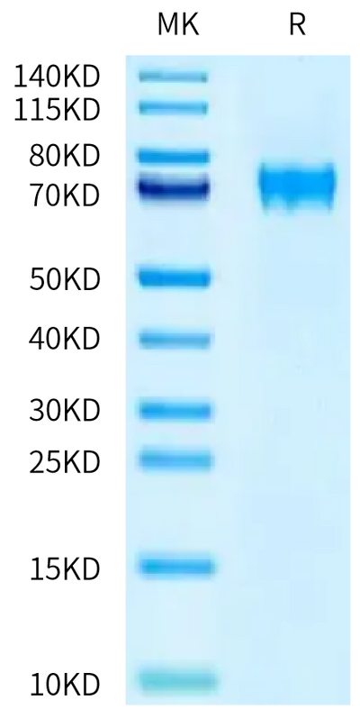 Human FLRT1 on Tris-Bis PAGE under reduced condition. The purity is greater than 95%.Recombinant Human FLRT1 Protein, Active