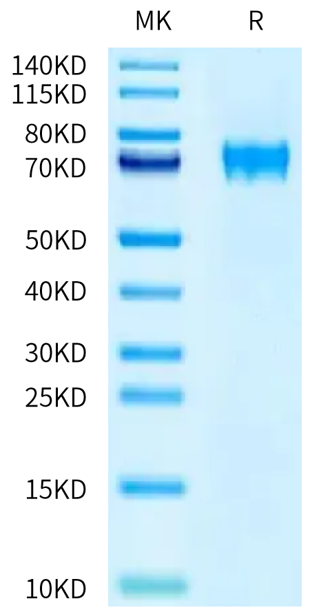 Human FLRT1 on Tris-Bis PAGE under reduced condition. The purity is greater than 95%.Recombinant Human FLRT1 Protein, Active
