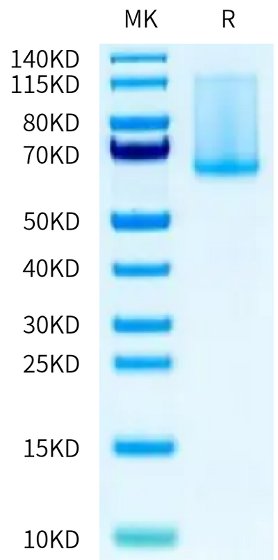 Cynomolgus ADAM9 on Tris-Bis PAGE under reduced condition. The purity is greater than 90%.Recombinant Cynomolgus ADAM9 Protein