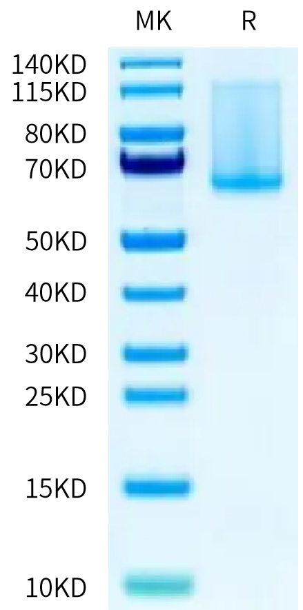 Cynomolgus ADAM9 on Tris-Bis PAGE under reduced condition. The purity is greater than 90%.Recombinant Cynomolgus ADAM9 Protein