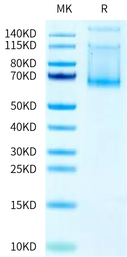Mouse ADAM9 on Tris-Bis PAGE under reduced condition. The purity is greater than 90%.Recombinant Mouse ADAM9 Protein