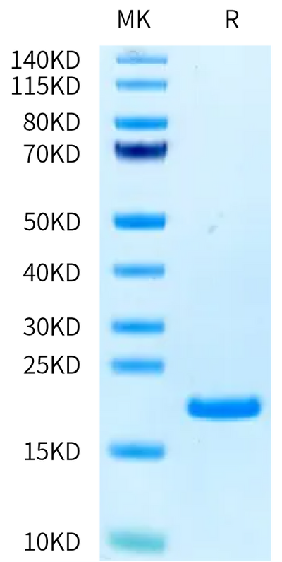 Human CD40 Ligand on Tris-Bis PAGE under reduced condition. The purity is greater than 95%.Recombinant Human CD40 Ligand/TNFSF5 Protein, Active