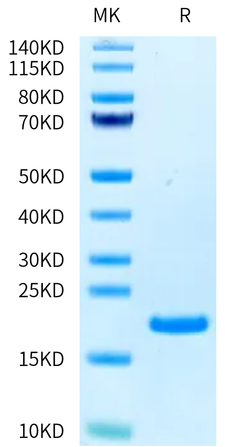 Human CD40 Ligand on Tris-Bis PAGE under reduced condition. The purity is greater than 95%.Recombinant Human CD40 Ligand/TNFSF5 Protein, Active