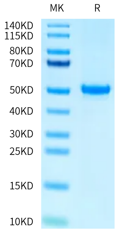 Human PAH (D415N) on Tris-Bis PAGE under reduced condition. The purity is greater than 95%.Recombinant Human PAH (D415N) Protein