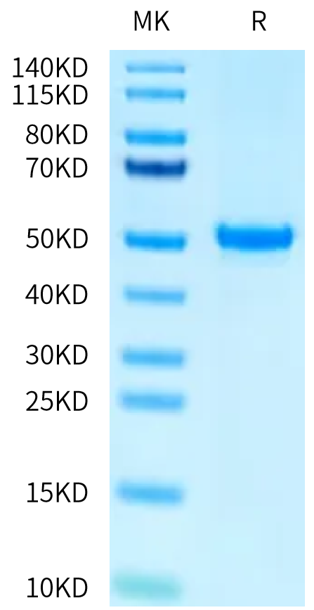 Human PAH (D415N) on Tris-Bis PAGE under reduced condition. The purity is greater than 95%.Recombinant Human PAH (D415N) Protein