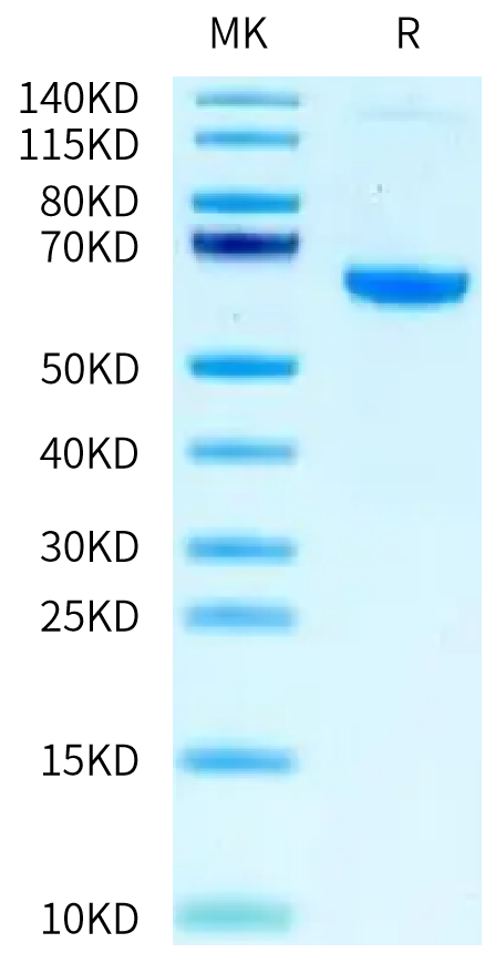 Mouse IGFBP-7 on Tris-Bis PAGE under reduced condition. The purity is greater than 95%.Recombinant Mouse IGFBP-7 Protein, Active
