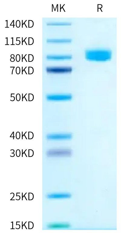 Human IL-18 R1 on Tris-Bis PAGE under reduced condition. The purity is greater than 95%.Recombinant Human IL-18 R1/CD218a Protein, Active