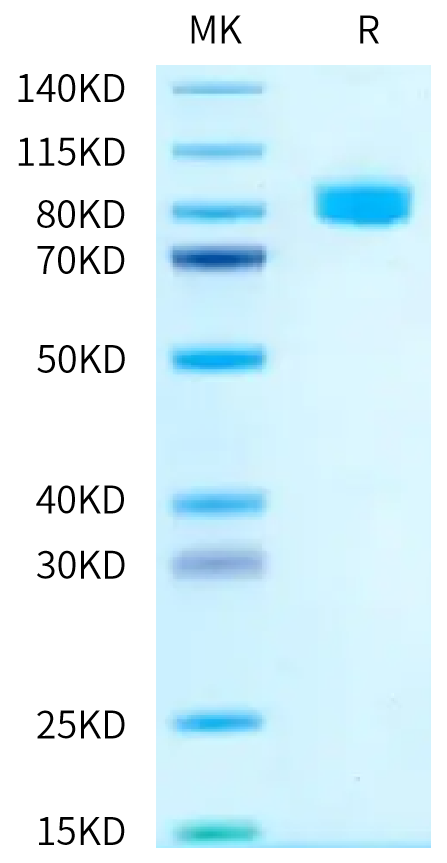 Human IL-18 R1 on Tris-Bis PAGE under reduced condition. The purity is greater than 95%.Recombinant Human IL-18 R1/CD218a Protein, Active