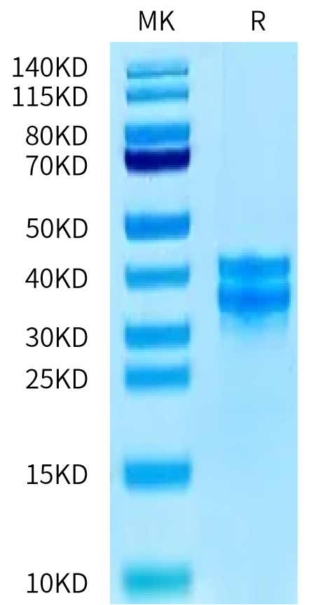 Human PBK on Tris-Bis PAGE under reduced condition. The purity is greater than 95%.Recombinant Human PBK/TOPK Protein