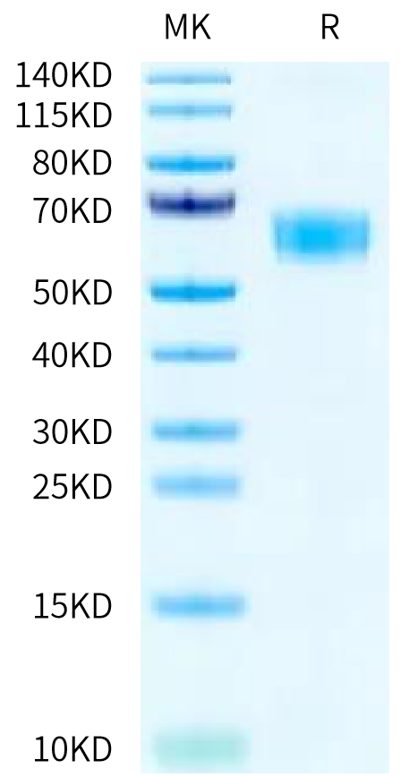 Rat CD47 on Tris-Bis PAGE under reduced condition. The purity is greater than 95%.Recombinant Rat CD47 Protein, Active